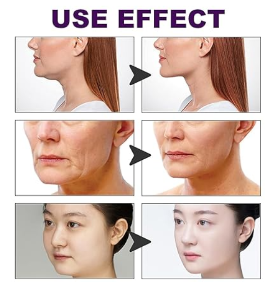 CINTA DE ESTIRAMIENTO FACIAL